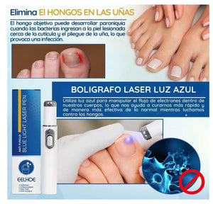 Lapiz Laser Azul Anti Hongos y Acne Import !